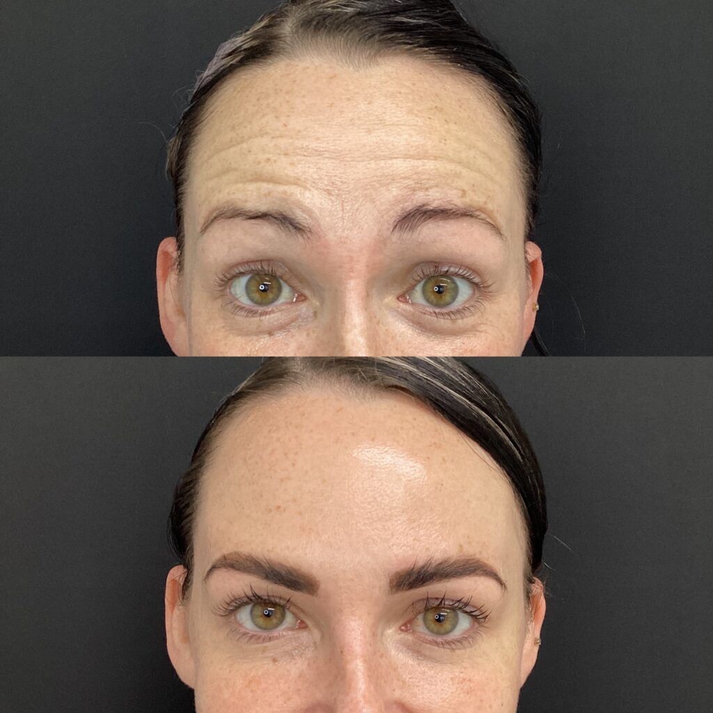 Skinma SEAL Program – SKINmas